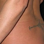 Liposuction Before & After Patient #23122