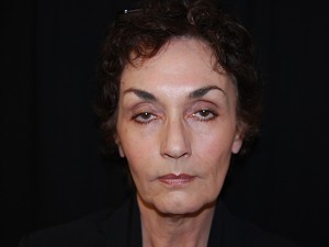 Facelift Before & After Patient #23533